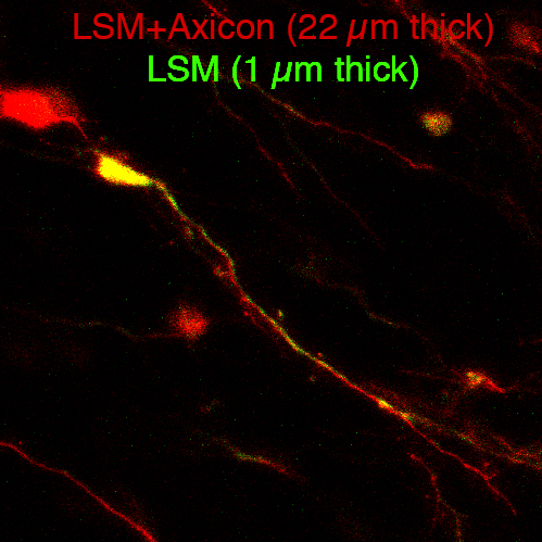 LMS+AxiconとLMSの比較