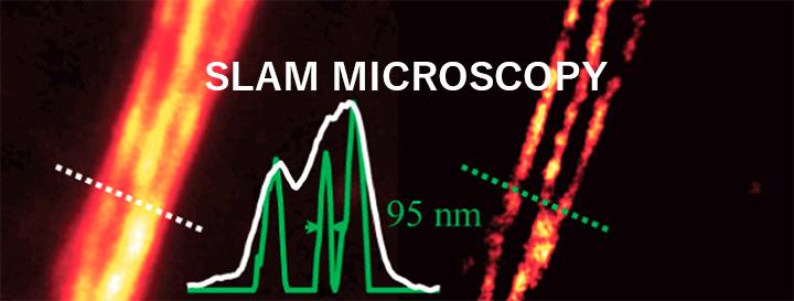 超解像レーザスキャニング共焦点＆多光子システム SLAM